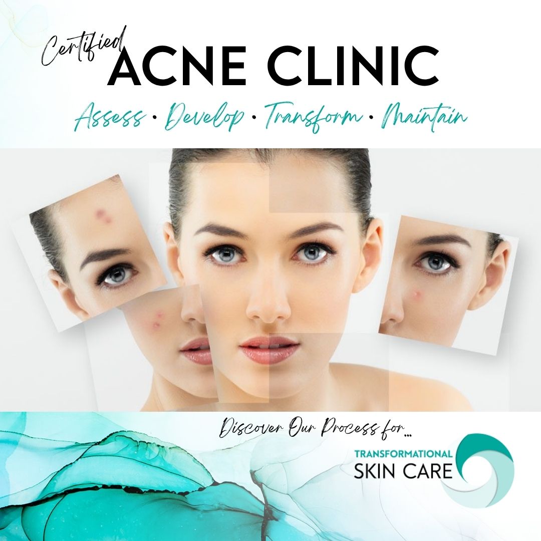 Click this image to Book your special offer treatment.