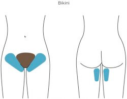illustration of difference between extended and brazilian wax 628.jpg