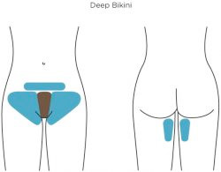 illustration of a basic bikini wax area 629.jpg