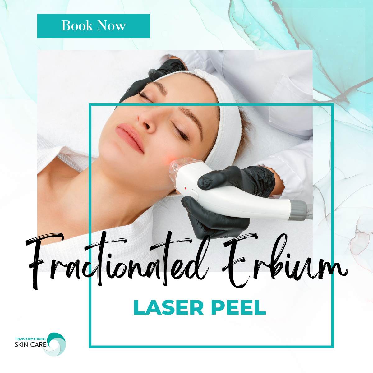 Click this image to book your Fractionated Erbium Laser Peel October special
